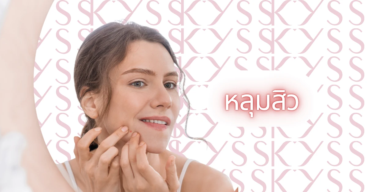 การรักษารอยสิวและหลุมสิวด้วยเลเซอร์ที่ KYSS Clinic สาขาบางจาก
