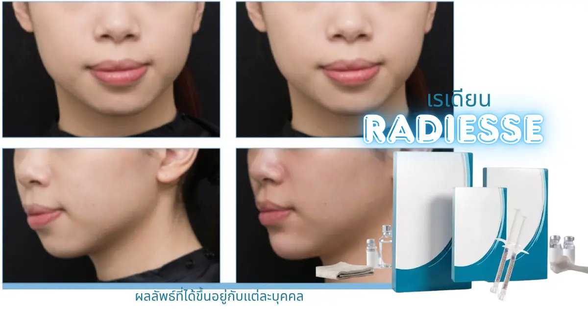 ตารางการประเมินสุขภาพผิวและความยืดหยุ่นของผิวหน้าเบื้องต้น สาขาบางจาก